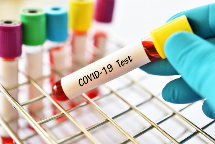 Chinese Certified COVID-19 (2019-nCoV) Test Kit Manufactures