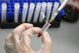 What is Nucleic Acid Detection?